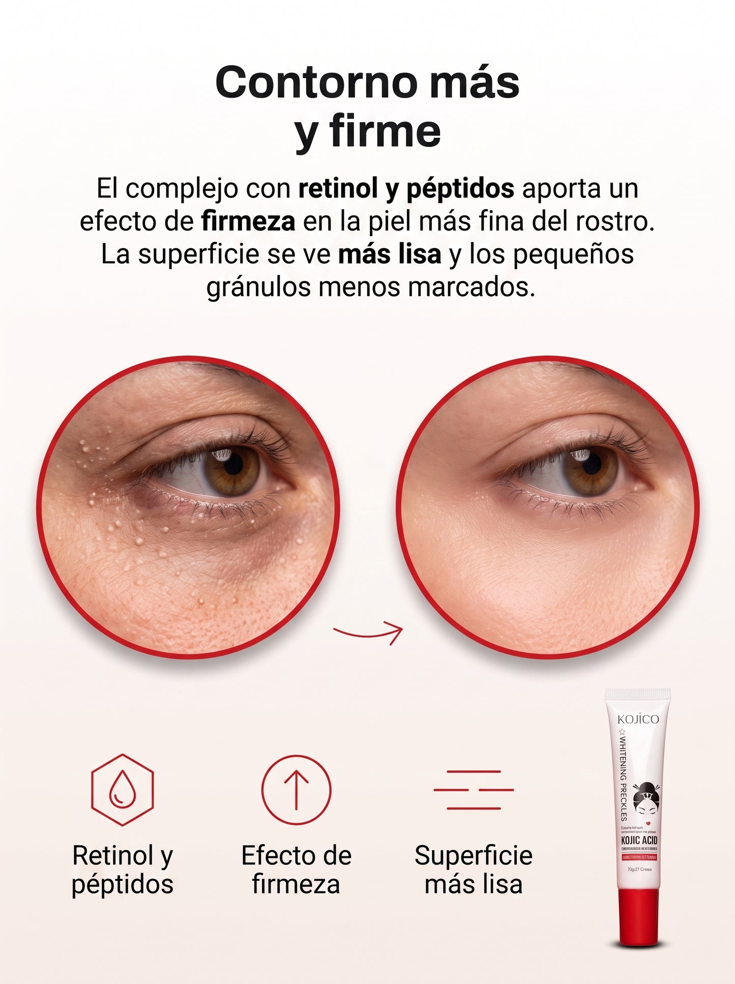 Kojico - Anti Granulos - Compre 1 Llevate 2 GRATIS 🎁